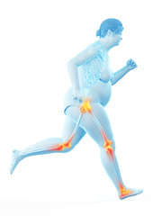 3d rendered medically accurate illustration of the painful joints of a running obese woman