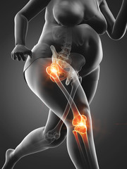 3d rendered medically accurate illustration of the painful joints of a running obese woman