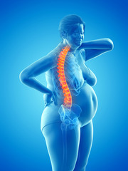 3d rendered medically accurate illustration of an overweight womans painful back