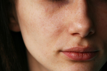 Fototapeta premium skin close-up with black dots