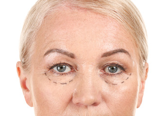 Mature woman with marks on her face against white background, closeup. Concept of plastic surgery