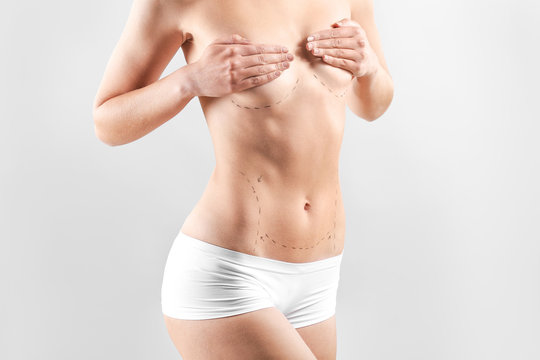 Naked woman with marks on her body against light background. Concept of plastic surgery