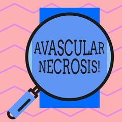 Text sign showing Avascular Necrosis. Business photo text death of bone tissue due to a lack of blood supply Round magnifying glass with iron handle frame to make object look bigger