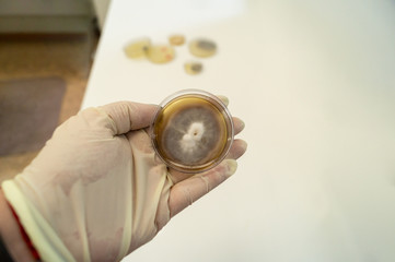 Mold grown on a Sabouraud agar medium in a Petri dish