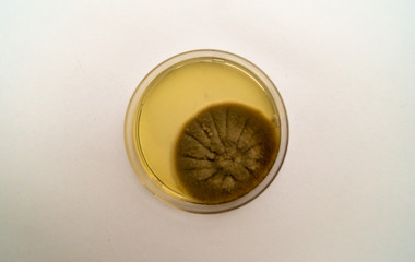 Mold grown on a Sabouraud agar medium in a Petri dish