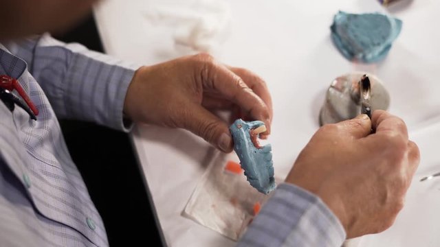 Mandible lower jaw preparation of removable partial denture cast, close up shot