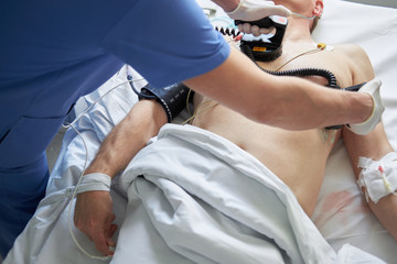 Doctor intensivist performs defibrillation to critical patient - obrazy, fototapety, plakaty
