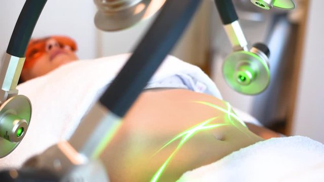 Laser treatment, loose weight on stomach. Medical center or spa.