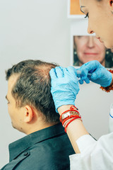 A young man with a bald spot in the office of a trichologist cosmetologist. Mesotherapy of hair and...