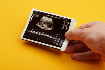 Ultrasound scan with future baby parameters 