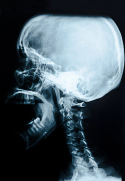 Film x-ray skull.