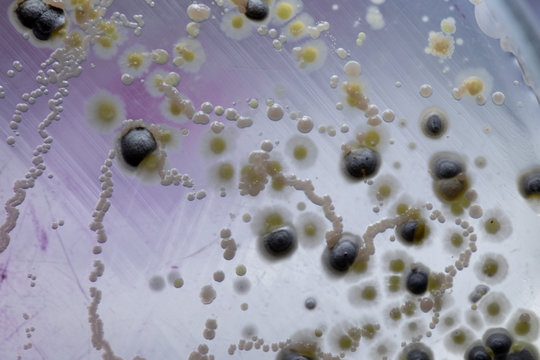 Mold Beautiful, Colony of Characteristics of Fungus (Mold) in culture medium plate from laboratory microbiology.