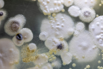 Mold Beautiful, Colony of Characteristics of Fungus (Mold) in culture medium plate from laboratory microbiology.