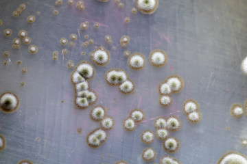 Mold Beautiful, Colony of Characteristics of Fungus (Mold) in culture medium plate from laboratory microbiology.