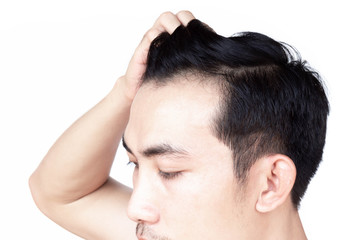 Young man serious hair loss problem for health care medical and shampoo product concept