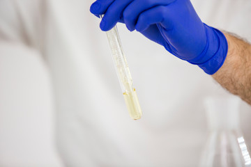 Male scientist working with pharmaceutical cbd oil in a laboratory with glass equipment