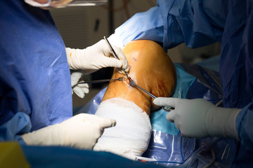 Knee Surgery