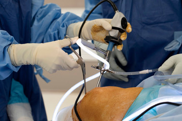 Knee Surgery