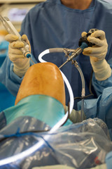 Knee Surgery