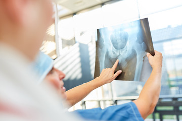 Radiologe zeigt auf Befund auf dem Röntgenbild