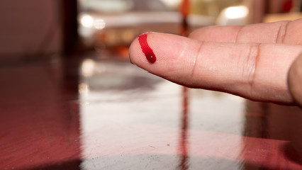 A finger on human hand is cut hurt and bleeding with bright red blood