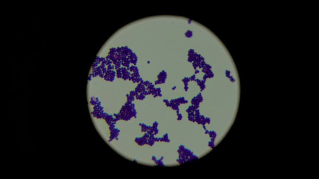 A focus changing shot of staphylococcus bacteria under the microscope. Sample of anaerobic organism. Laboratory and medical research concept.