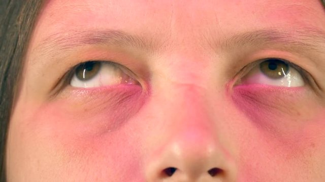 Young woman with tired eyes from long work at computer shows various exercises for eyes, approved by doctor. Gymnastics against strabismus. Remedial exercises. Ophthalmological allowance