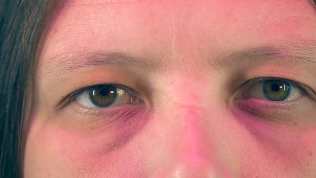Young woman with tired eyes from long work at computer shows various exercises for eyes, approved by doctor. Gymnastics against strabismus. Remedial exercises. Ophthalmological allowance