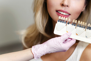 White teeth and beautiful smile of a young woman. Matching the shades of the implants using shade guide. Preparation for teeth whitening in dental office. Closeup macro white background isolated