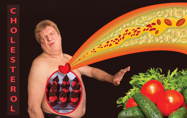 Cholesterol. The diet no concept
