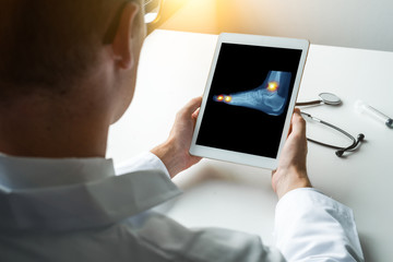 Doctor holding a digital tablet with x-ray of a pain on the ankle and toes