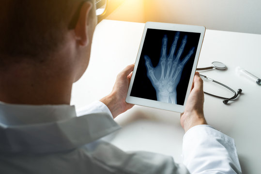 Doctor holding a digital tablet with x-ray of a right hand. Osteoarthritis concept