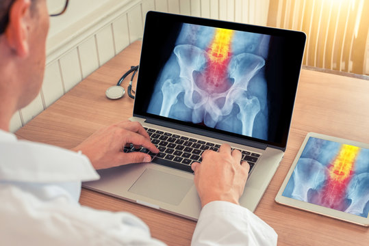 Doctor watching a laptop and digital tablet with x-ray of hips with pain relief on the spine in a medical office