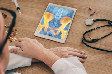 Doctor watching a digital tablet with x-ray of hips with pain in the bones