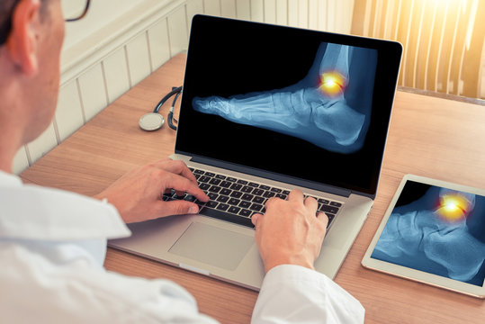 Doctor watching a laptop and a digital tablet with x-ray of pain relief on the ankle of a foot in a medical office
