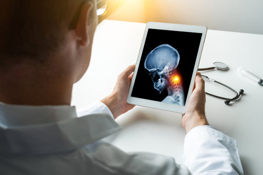 Doctor holding a digital tablet with x-ray of spine with pain in the neck. Migraine and headache concept
