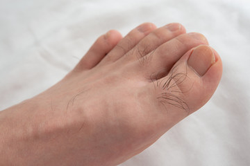 メンズ　足指脱毛　beforeイメージ