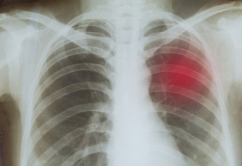 Body radiography