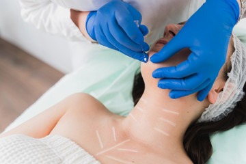 Fototapeta premium Mesonites treatment for rejuvenation