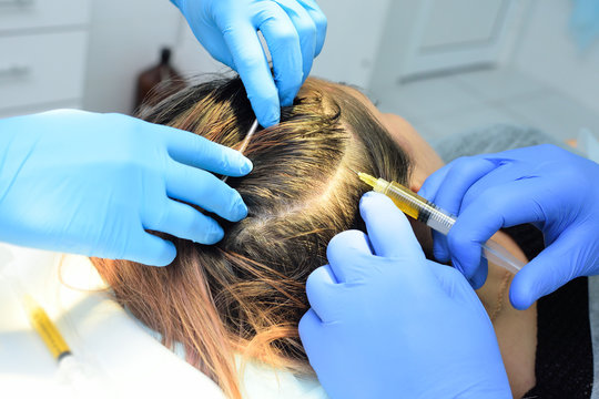 doctor cosmetologist dermatologist injects the plasma into the scalp of the patient. Plasma treatment, plasmolifting or PRP method point the introduction of the patient's own plasma enriched with plat