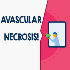 Word writing text Avascular Necrosis. Business photo showcasing death of bone tissue due to a lack of blood supply Man stands in window hold loudspeaker speaking trumpet without listener