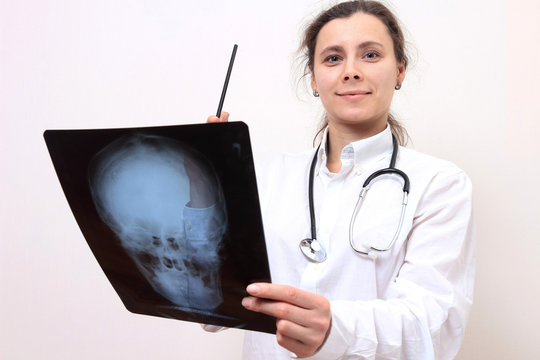 Young woman doctor with xrays of head. X ray image in hand of female doctor