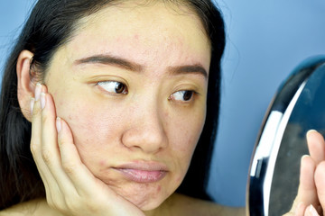 Asian woman looking at herself in the mirror, Female feeling annoy about her reflection appearance show the aging facial skin signs, wrinkles, dark spot, pimple, acne scar, large pores, dull skin.