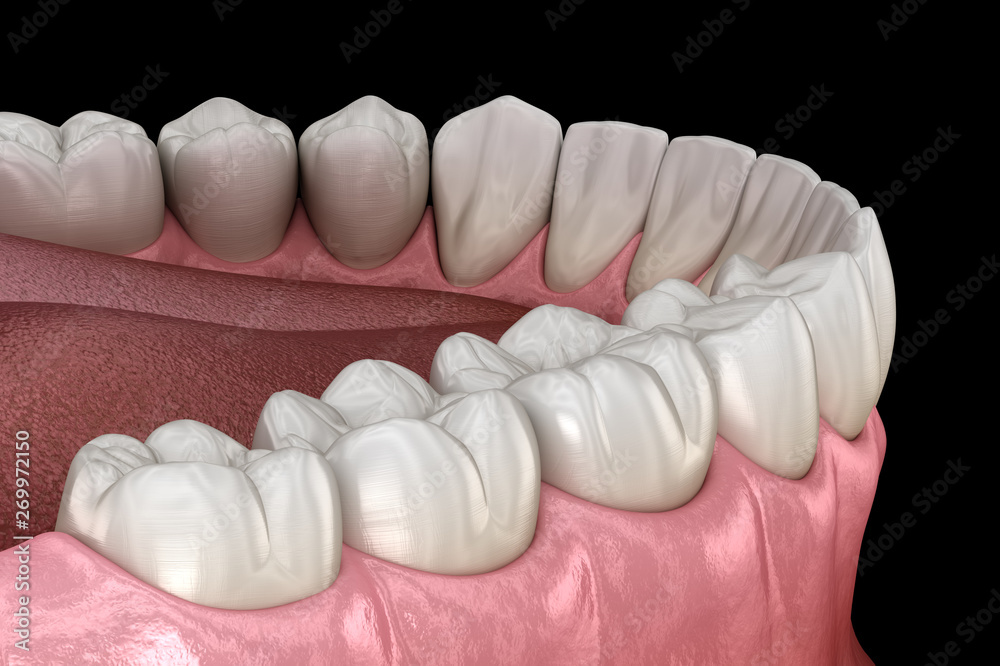 Wall mural Mandibular human gum and teeth. Medically accurate tooth 3D illustration