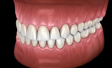 Healthy human teeth with normal occlusion, side view. Medically accurate tooth 3D illustration
