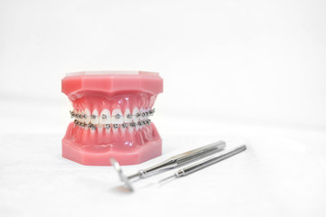 dental model with braces - Teeth orthodontic dental model with dental braces