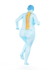 3d rendered medically accurate illustration of an obese womans