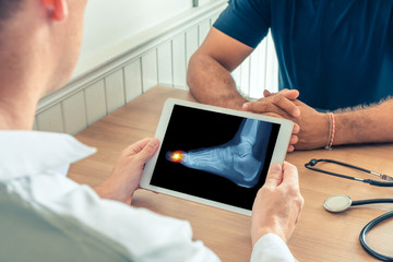 Doctor holding a digital tablet with x-ray of foot of the patient. Pain on the toe