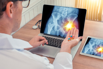 Doctor holding pills with x-ray of hips with pain on the right on a laptop. Digital tablet on the wooden desk