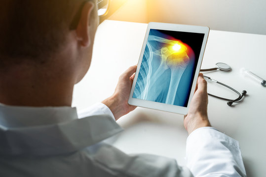 Doctor holding a digital tablet with x-ray of chest with pain on the shoulder